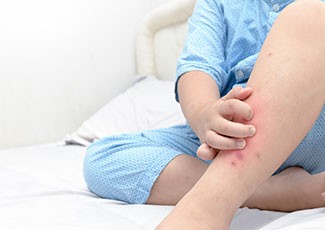 Tips Hindari Si Kecil Dari Gigitan Nyamuk DBD